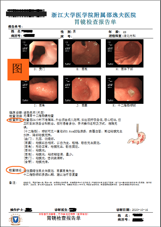 胃镜检查报告显示肠化严重及应对措施