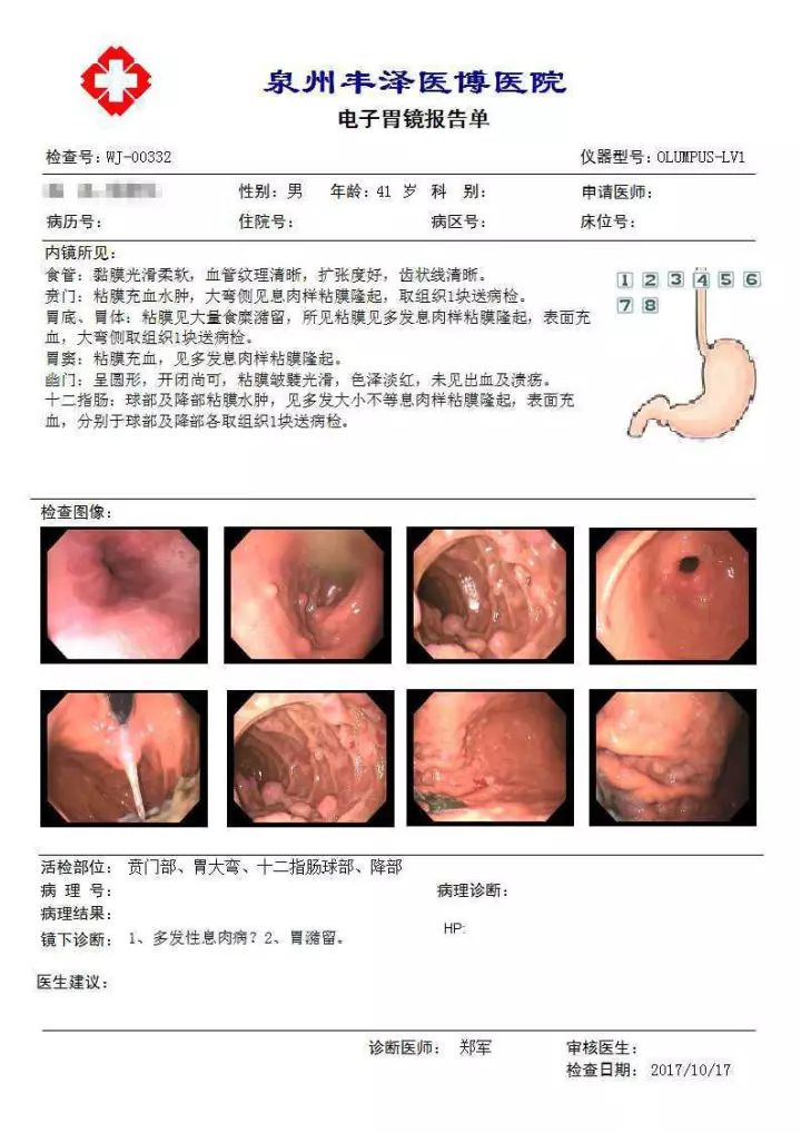 胃镜检查报告显示肠化严重及应对措施