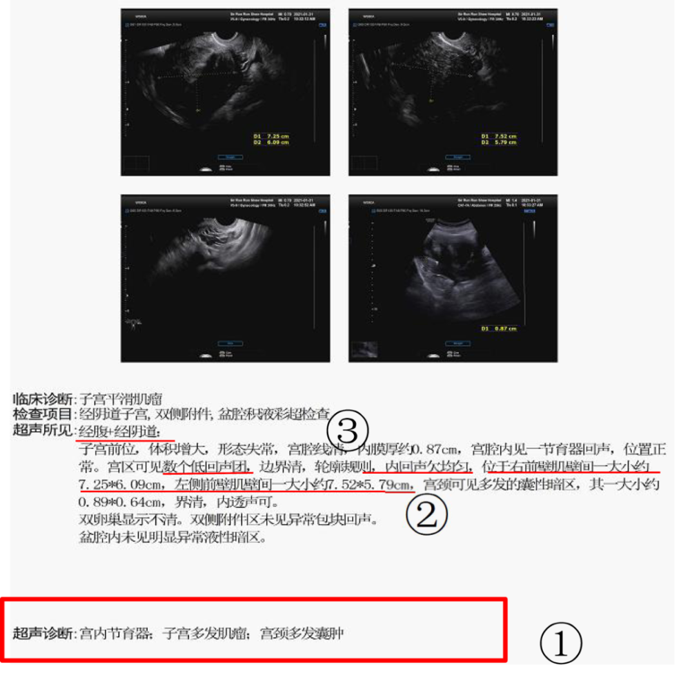 胃镜检查报告GTST含义解析：揭开其背后的健康密码