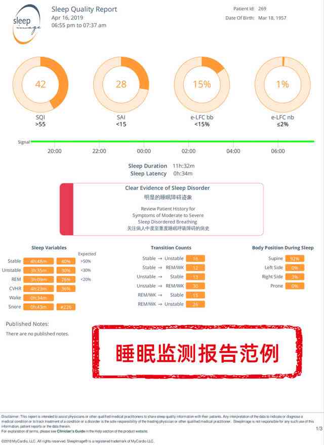 睡眠质量报告AI生成是什么：原理与应用解析