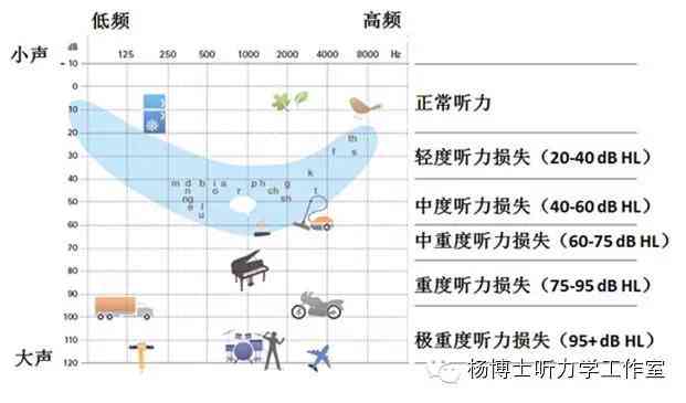 听力报告AI：技术分析与应用趋势