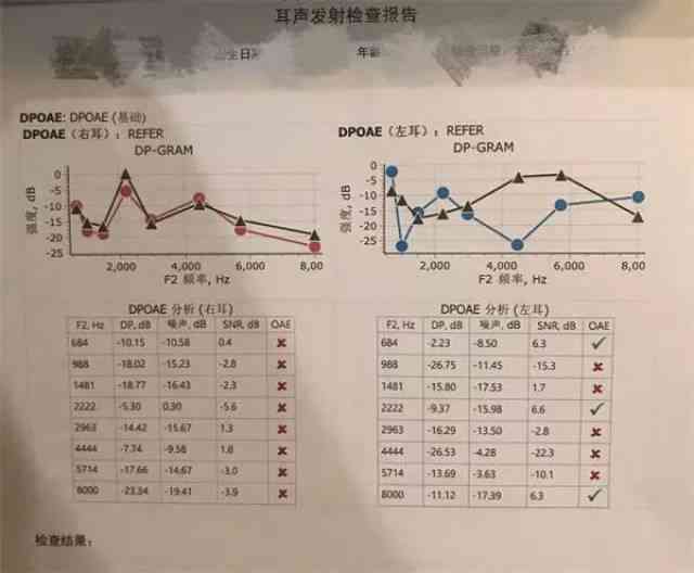 听力报告AI什么意思