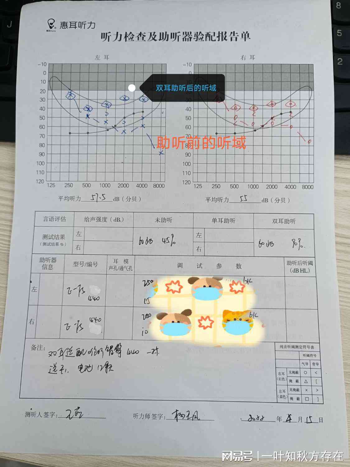 听力报告AI什么意思