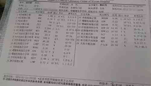 解读血液检测报告单：各项目指标意义详解