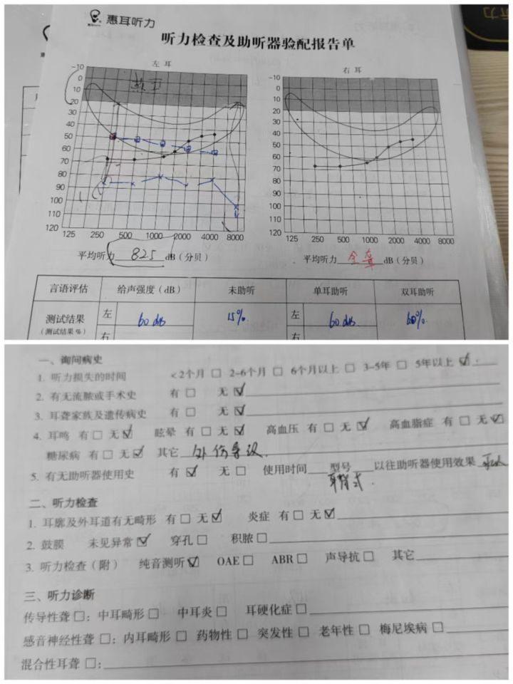 全面解读：AI听力测试报告单的含义、作用与常见问题解答