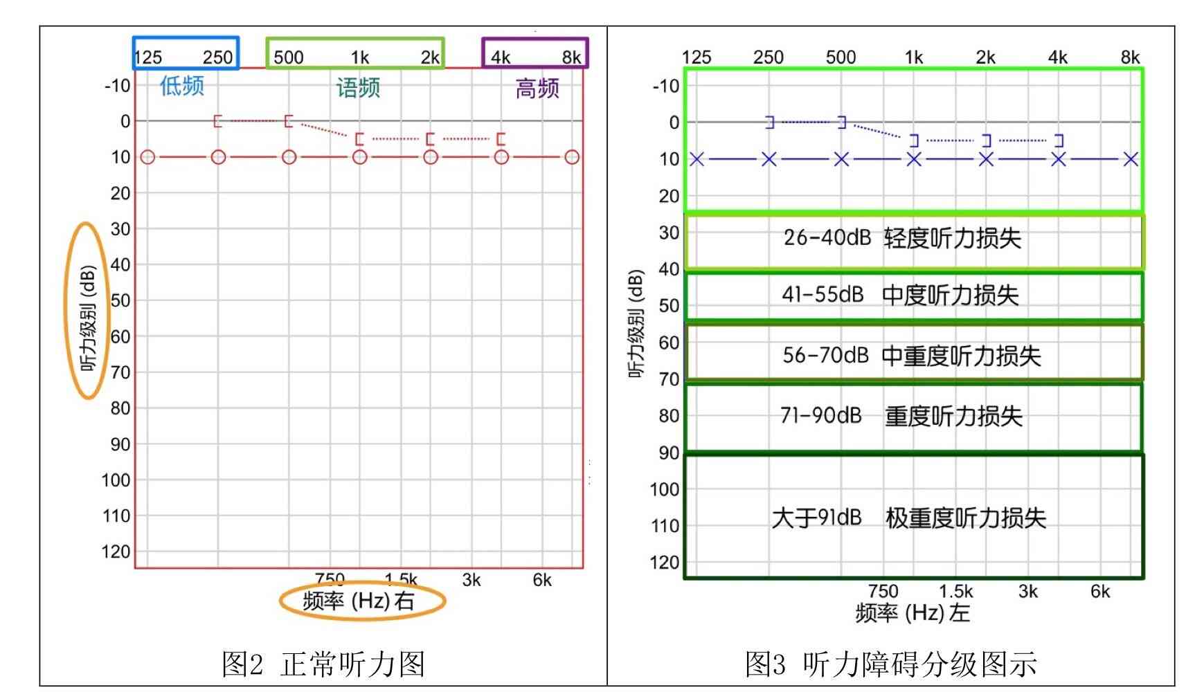 新基于听力测试报告AC的音频辨识能力评估分析