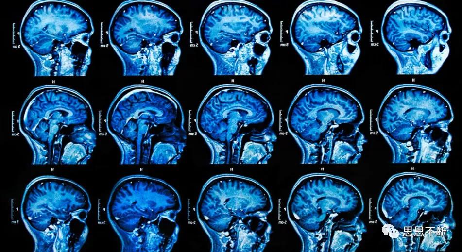 AI诊断报告：评估肺功能与呼吸系统健康