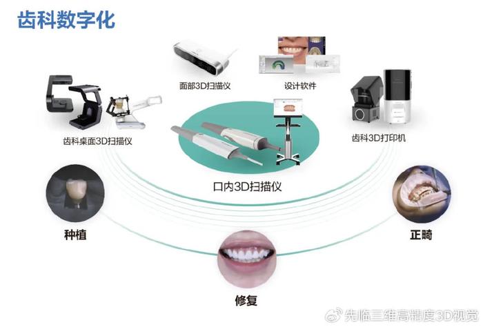 口腔数字化AI报告怎么写：流程、技术与优点概述