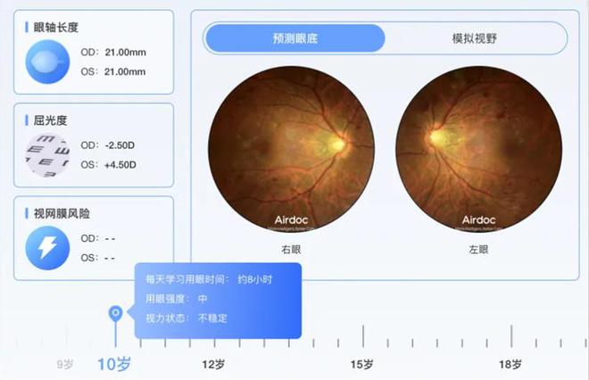 宝岛AI眼底相机的报告怎么看？在哪里查看？眼镜店的AI眼底照相机准确吗？