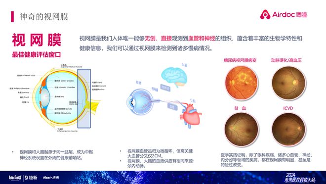 宝岛AI眼底相机的报告怎么看？在哪里查看？眼镜店的AI眼底照相机准确吗？