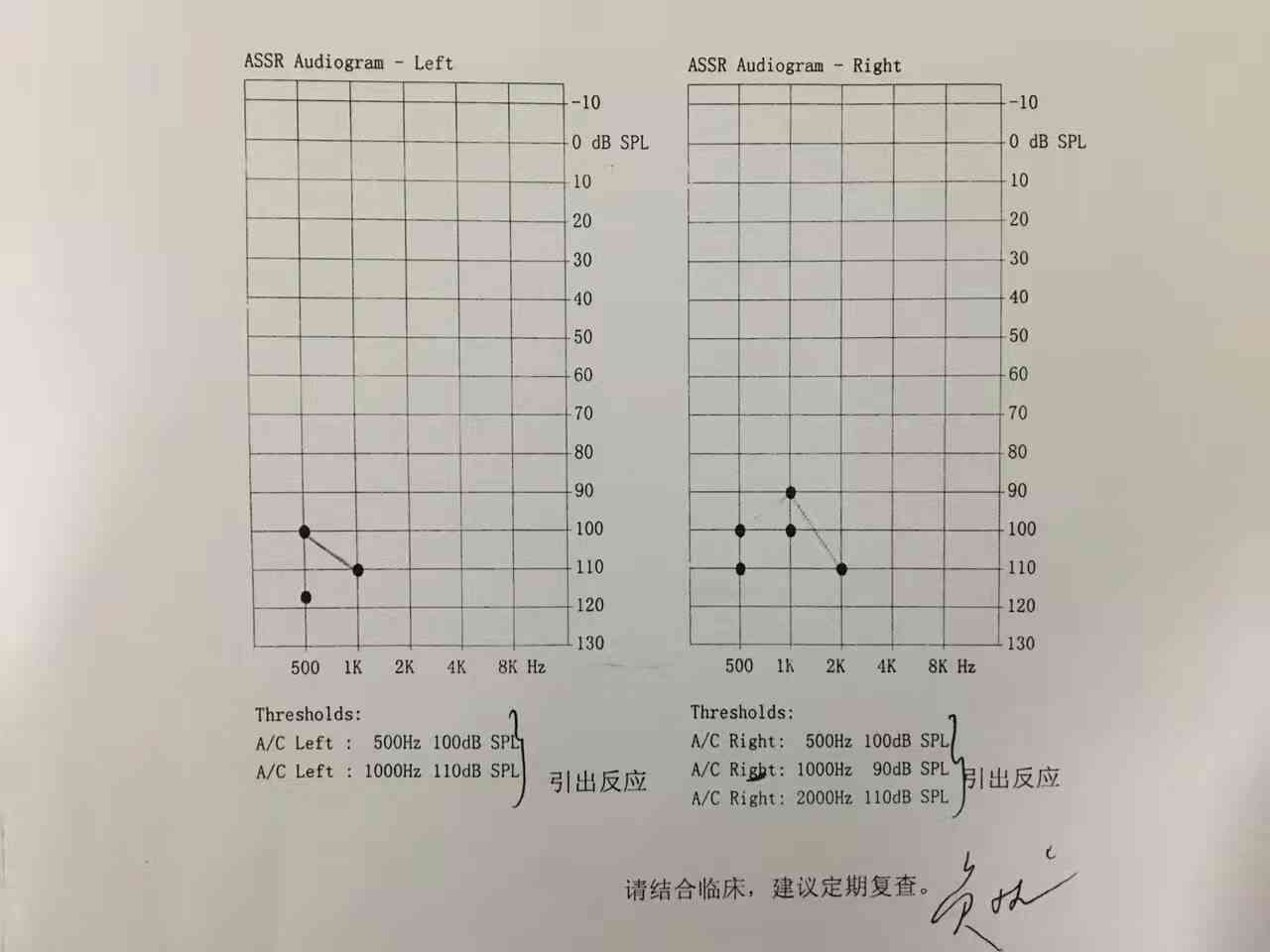 听力报告中ai是什么