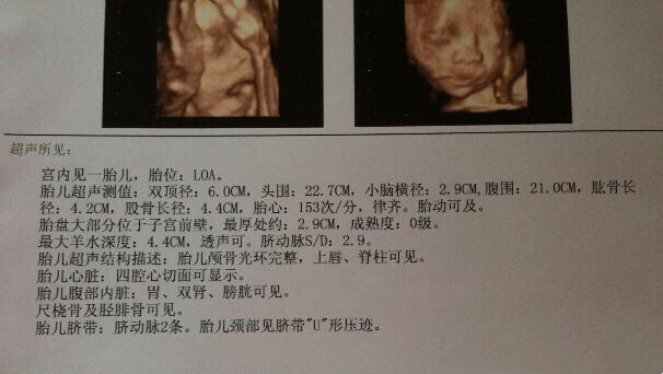 四维超声预测预产期的准确性分析与常见疑问解答