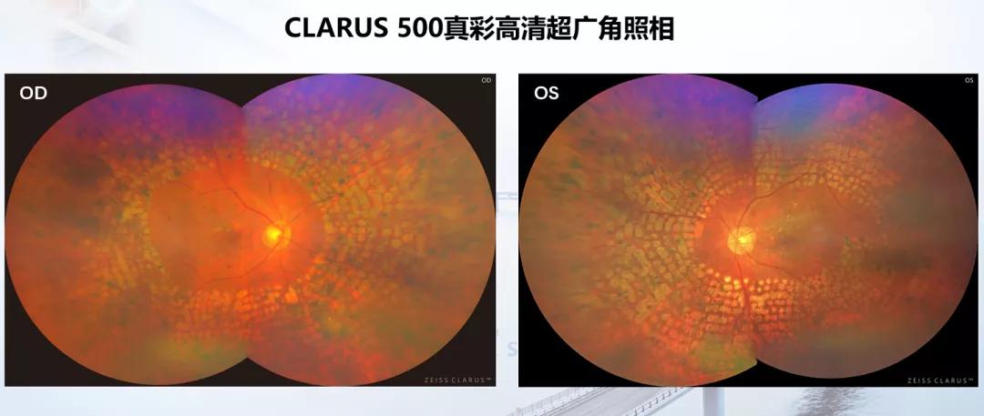 全面解析AI眼部识别技术最新进展与应用报告